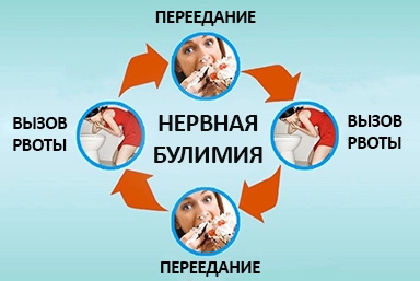 Лечение булимии в Сысерте